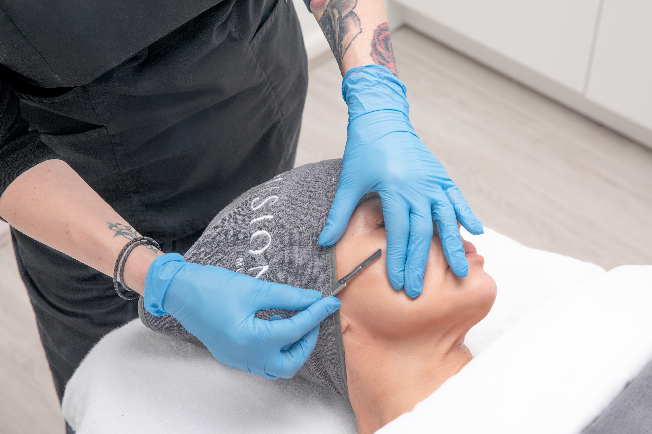 dermaplaning in Birmingham