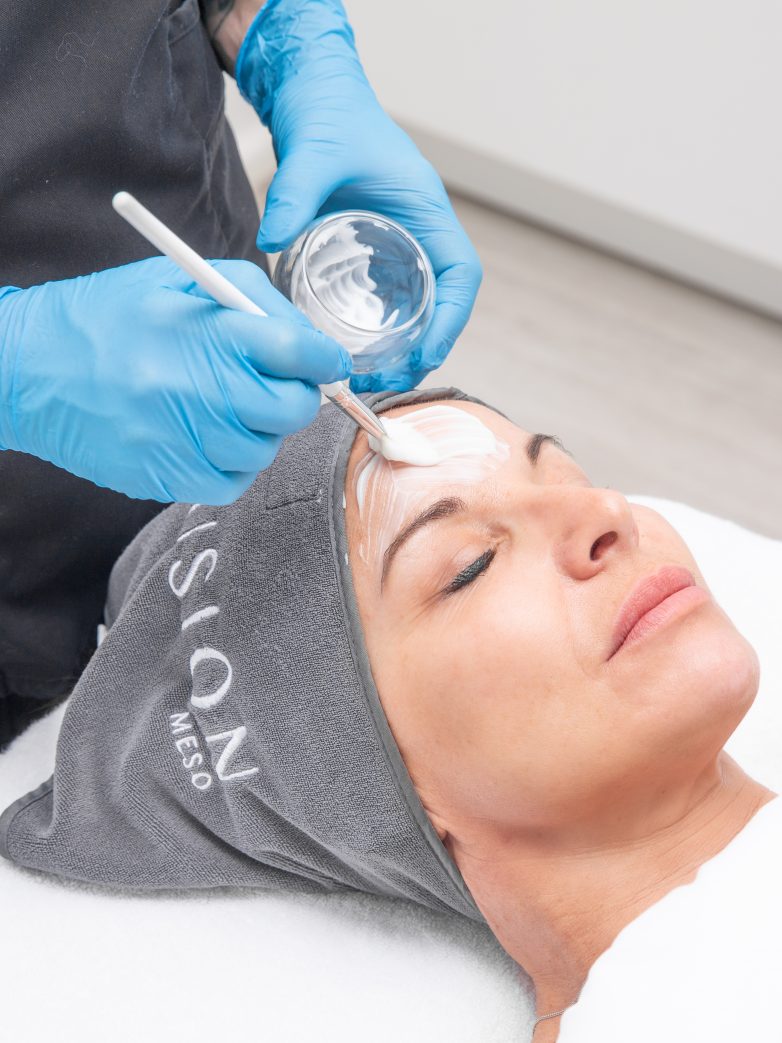Best Facials for Dry Skin in Birmingham This Winter