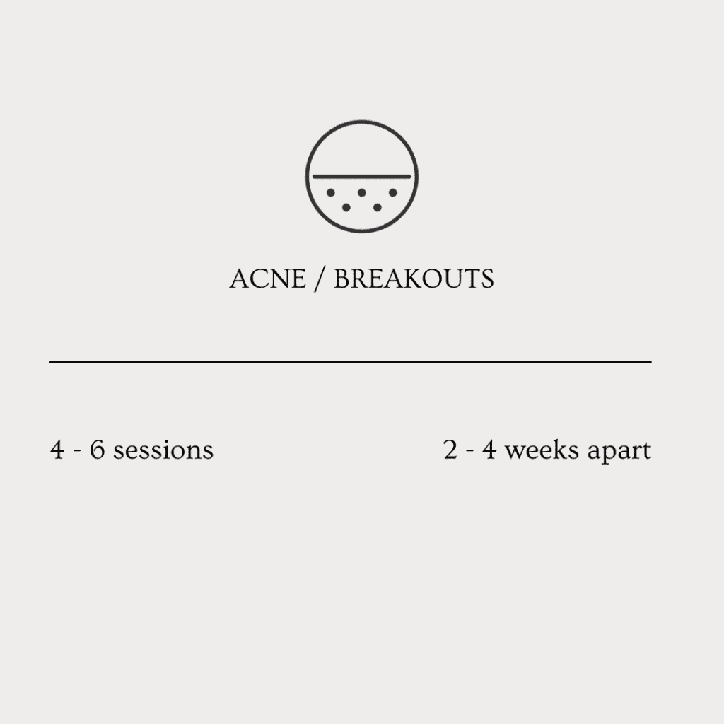 microneedling acne treatment sessions