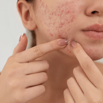 Guide to a Collagen Boosting Diet: Essential Foods for Healthy Skin
