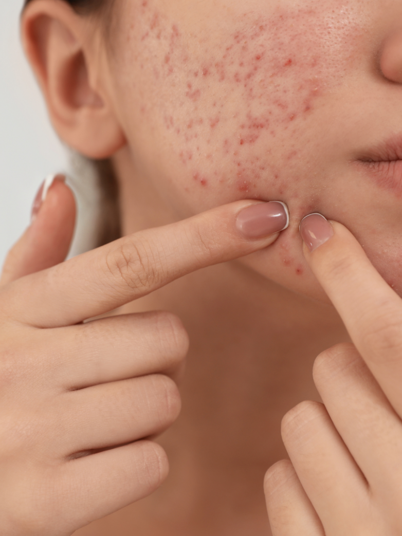 Guide to a Collagen Boosting Diet: Essential Foods for Healthy Skin