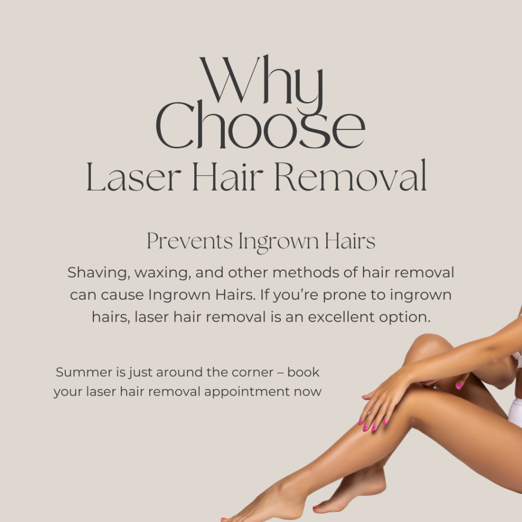 laser hair removal plan now for the summer