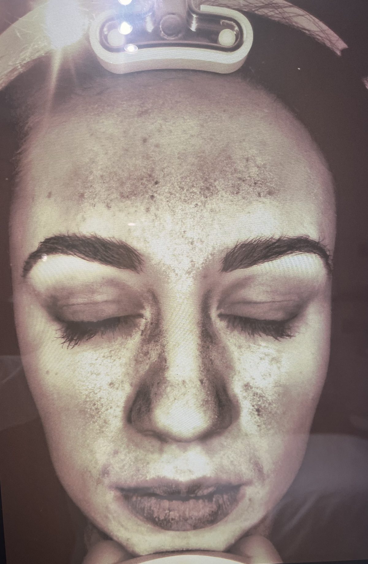 skin consultation skin analysis