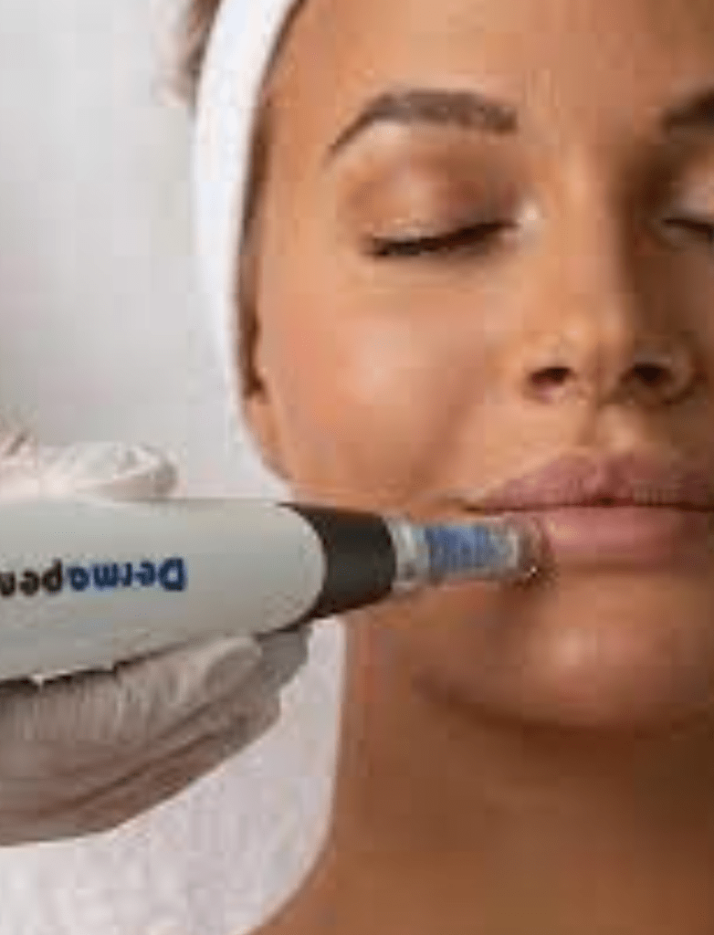 Is Microneedling Worth It After 40? The Truth from Our Birmingham Skin Clinic