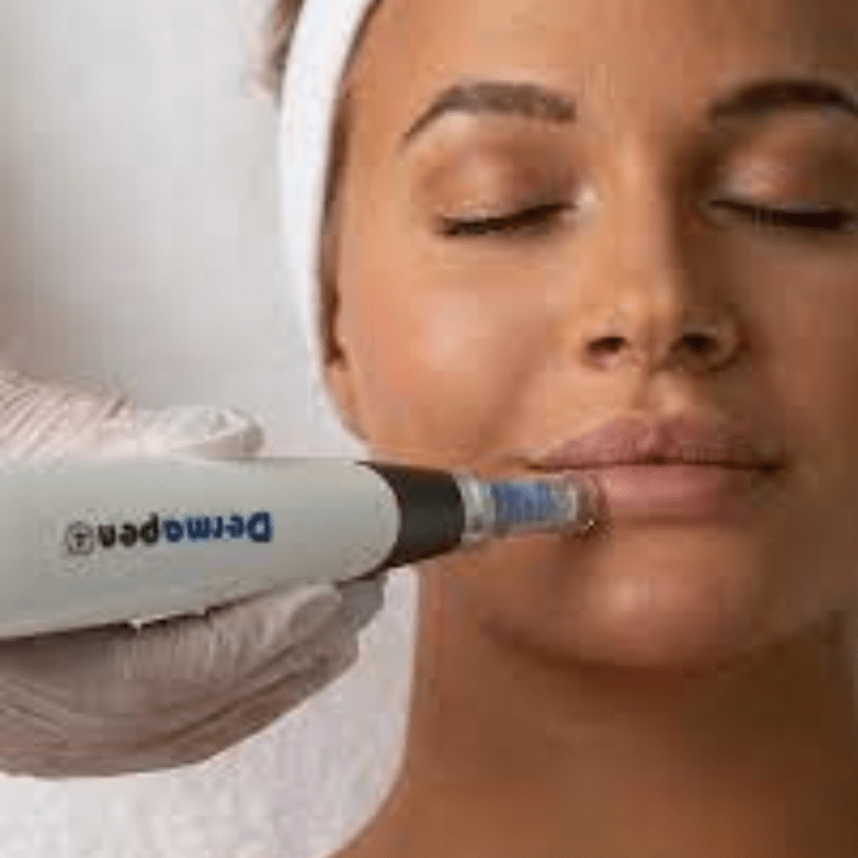 is microneedling worth it