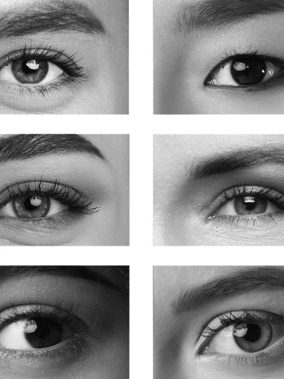 beautifeye treatment for all eyes in Birmingham