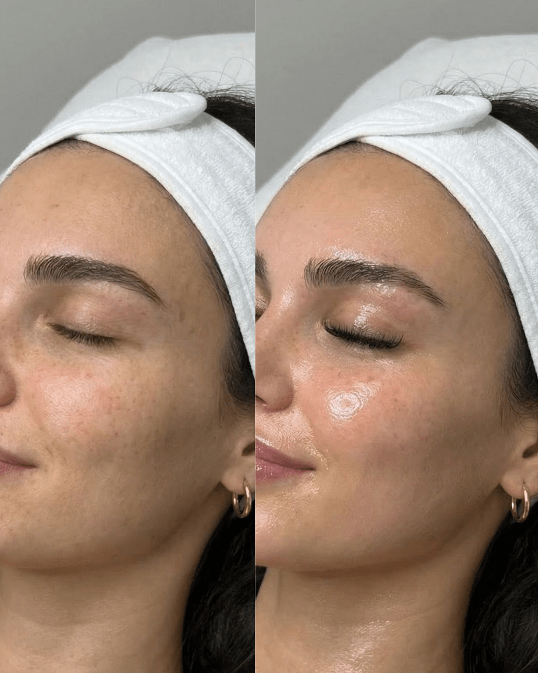 facial before and after results answering how often should you get a facial