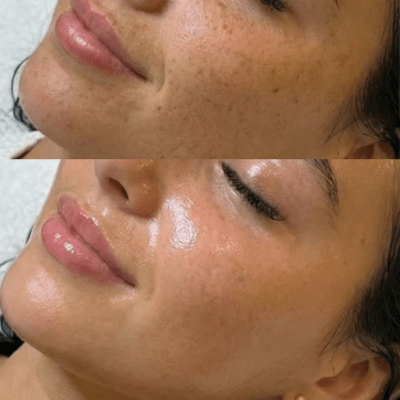 Skincare for Menopausal Skin: An Honest Guide From a Skin Specialist
