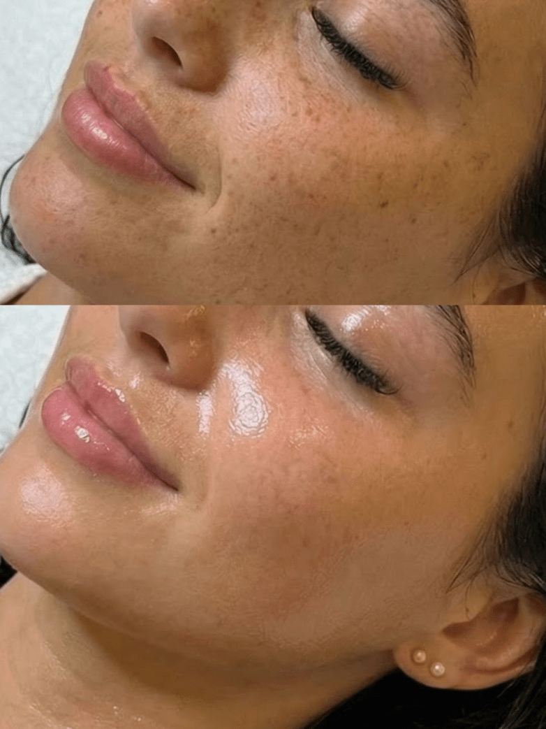 How Often Should You Get a Facial? A Facialist’s Honest Advice