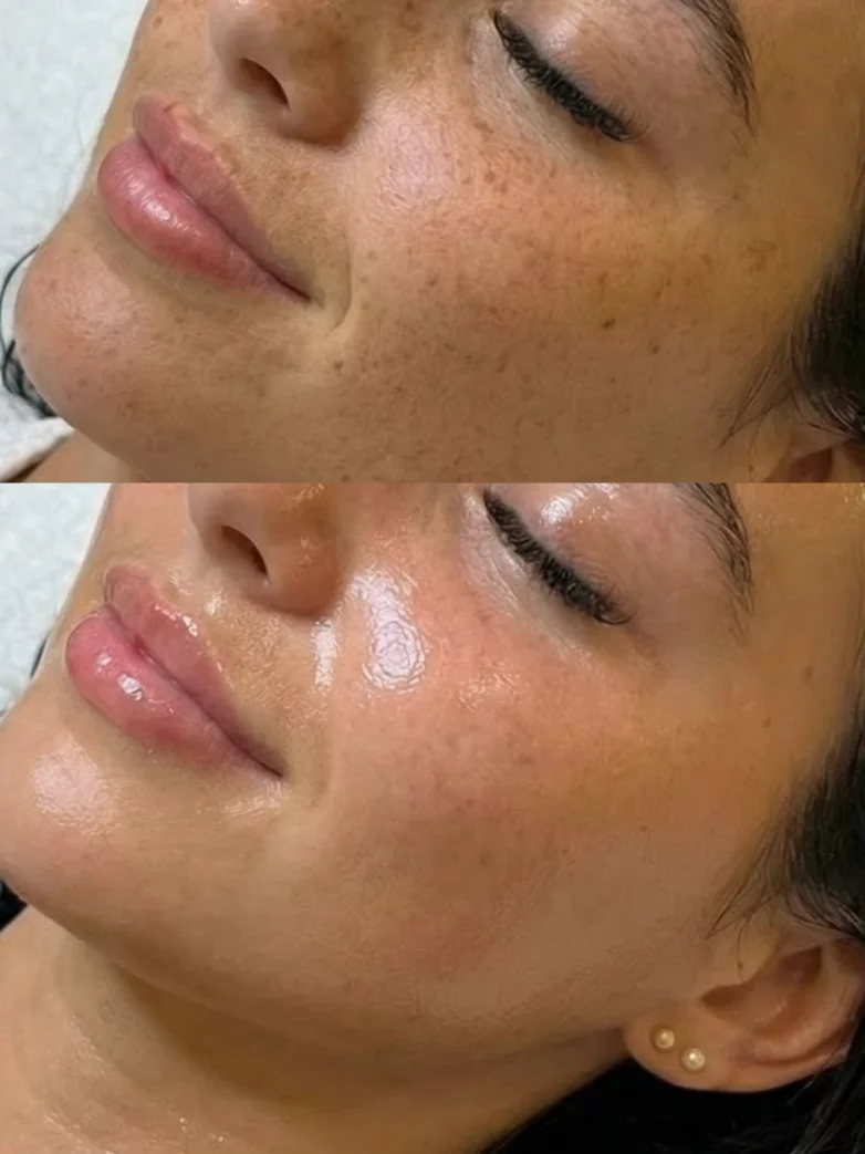 How Often Should You Get a Facial? A Facialist’s Honest Advice