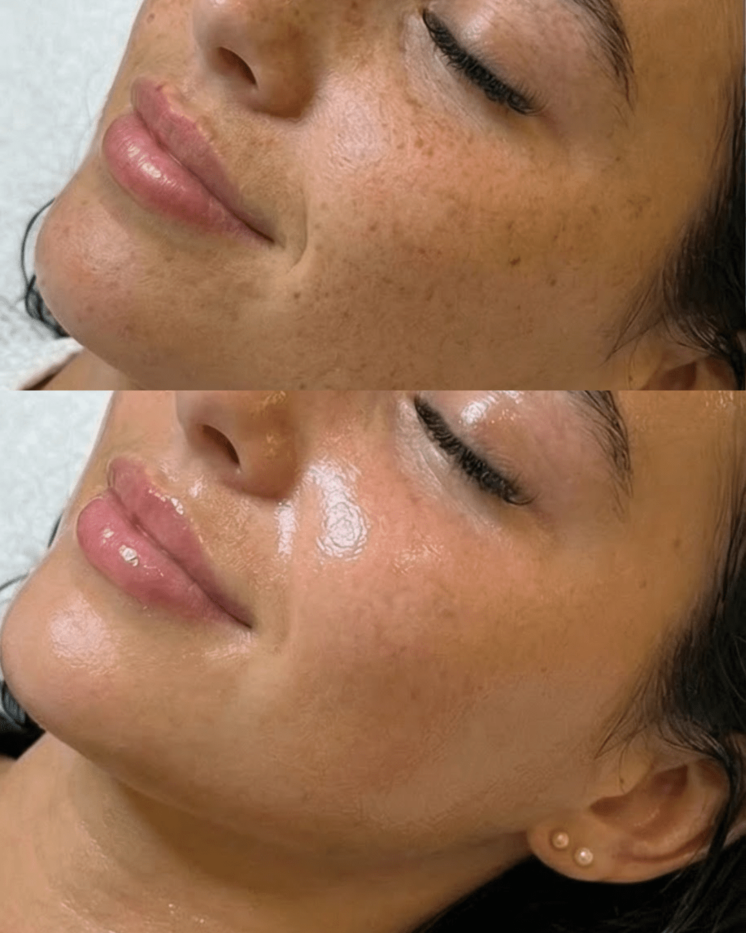 How Often Should You Get a Facial? A Facialist’s Honest Advice