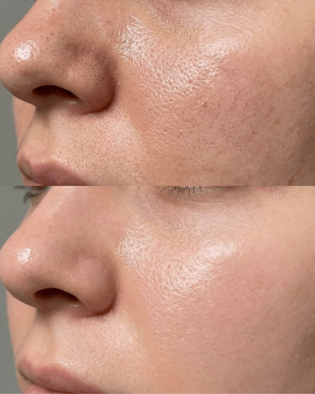 glass skin facial results at sorelle skin clinic in birmingham