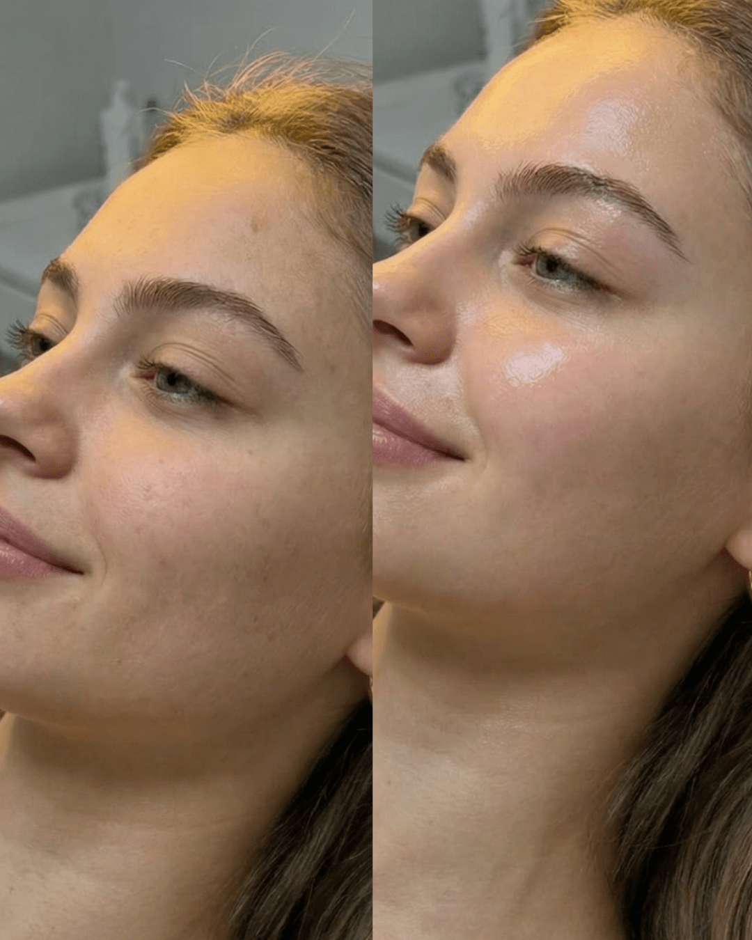 glass skin facial results birmingham