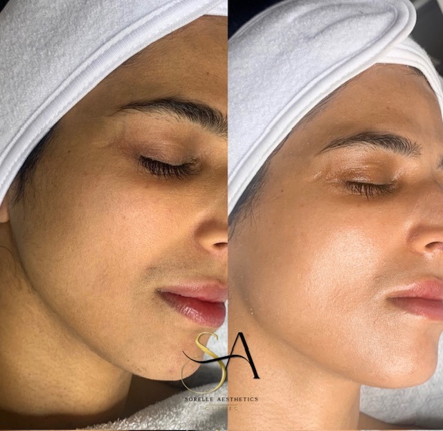 best facials in birmingham