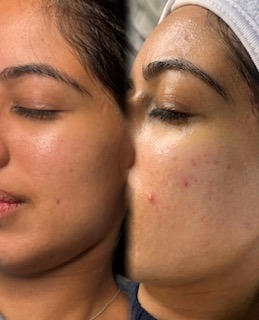 best facial in birmingham