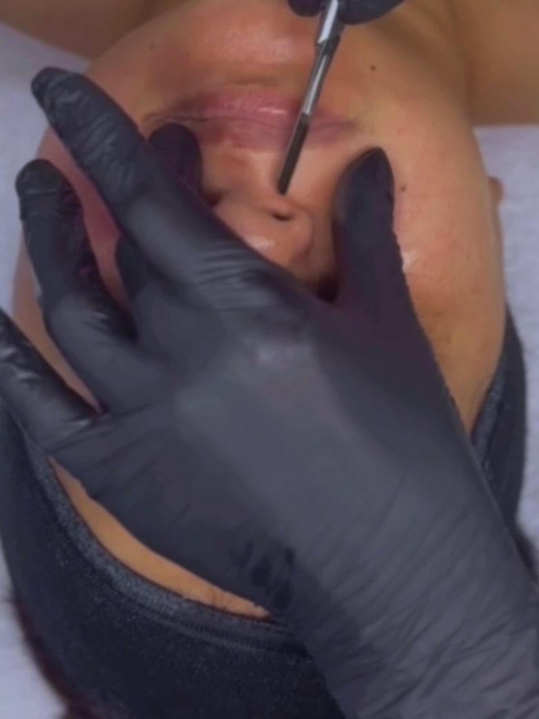 Dermaplaning Myths Debunked: What Molly-Mae Didn’t Tell You