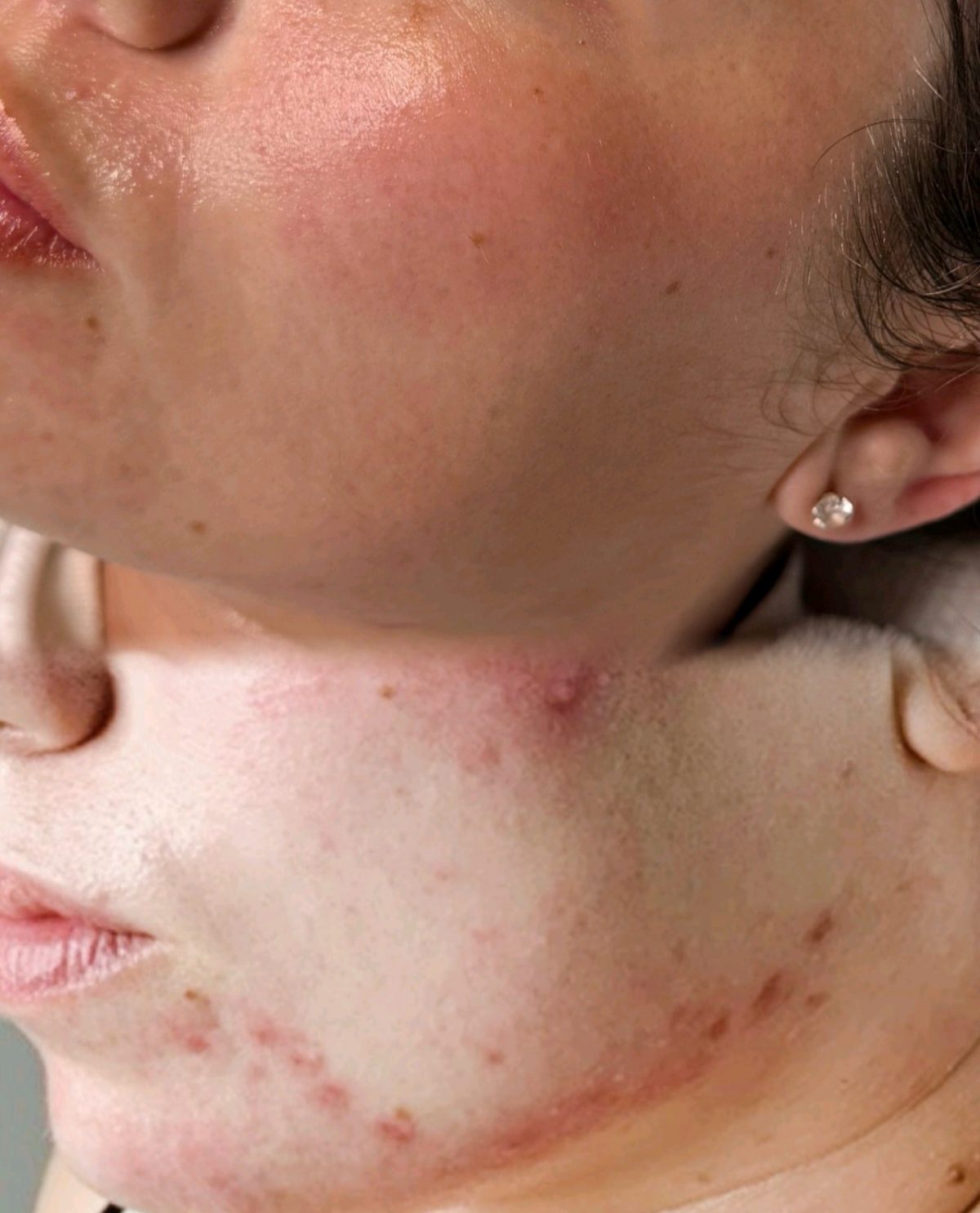 facials birmingham