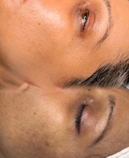 the skin confidence method