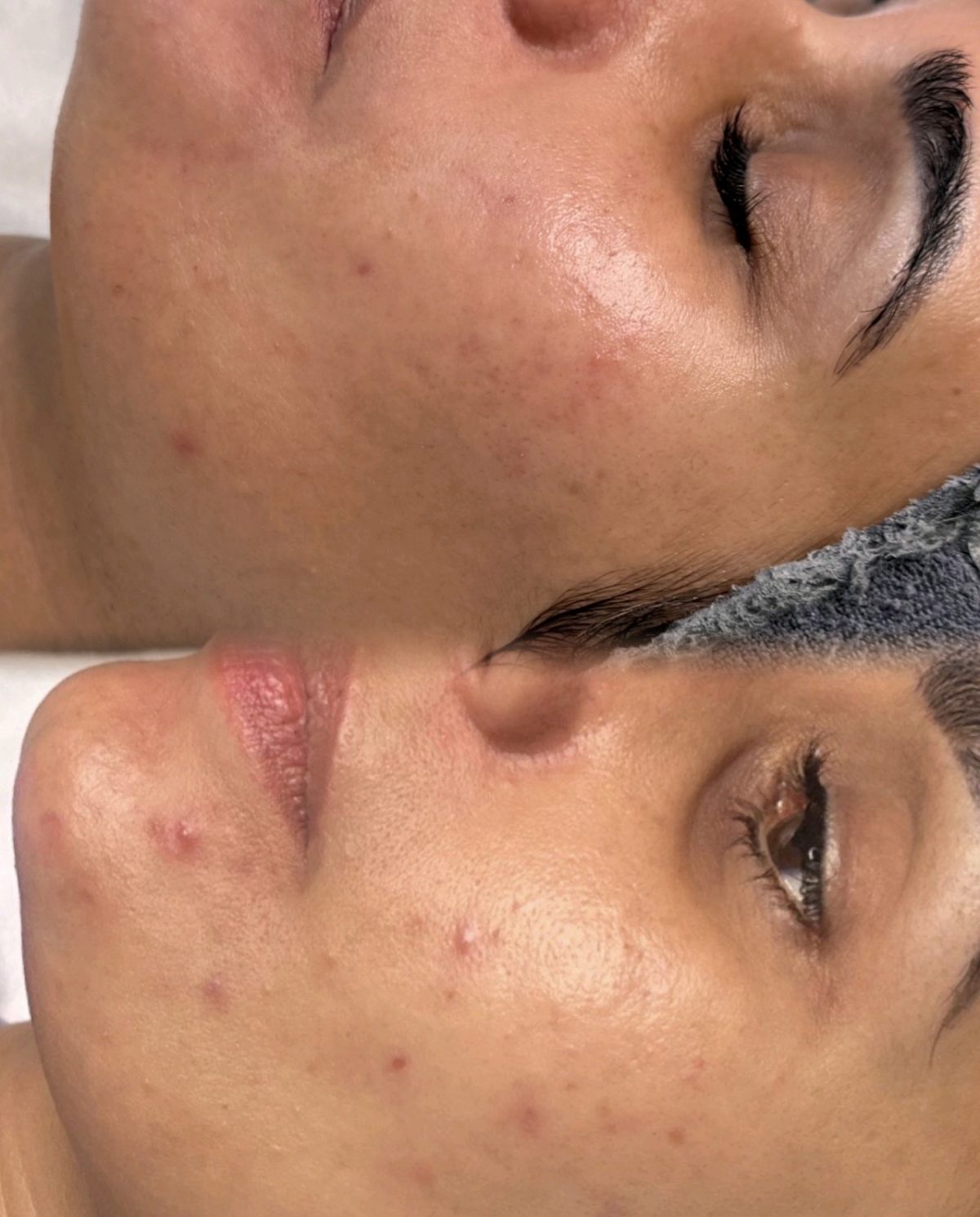 best facials in birmingham