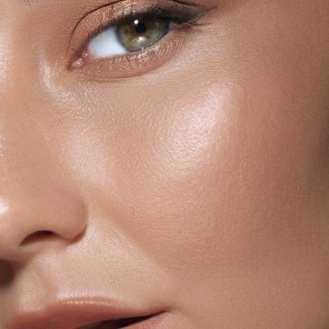 Microneedling for Pigmentation & Sun Damage in Birmingham – Does it Really Work?