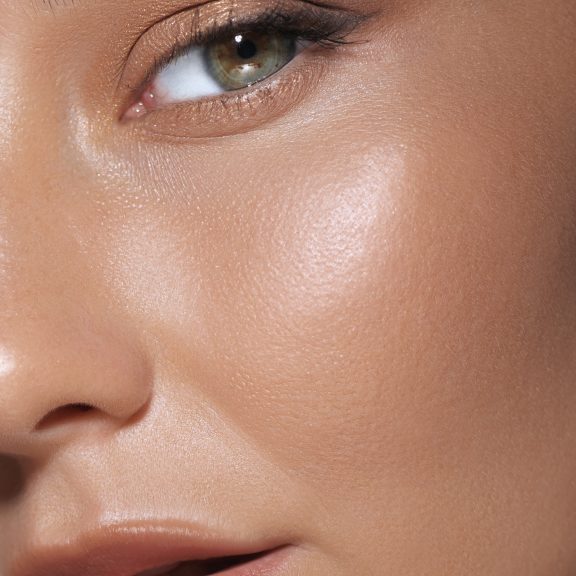 Microneedling for Pigmentation & Sun Damage in Birmingham – Does it Really Work?