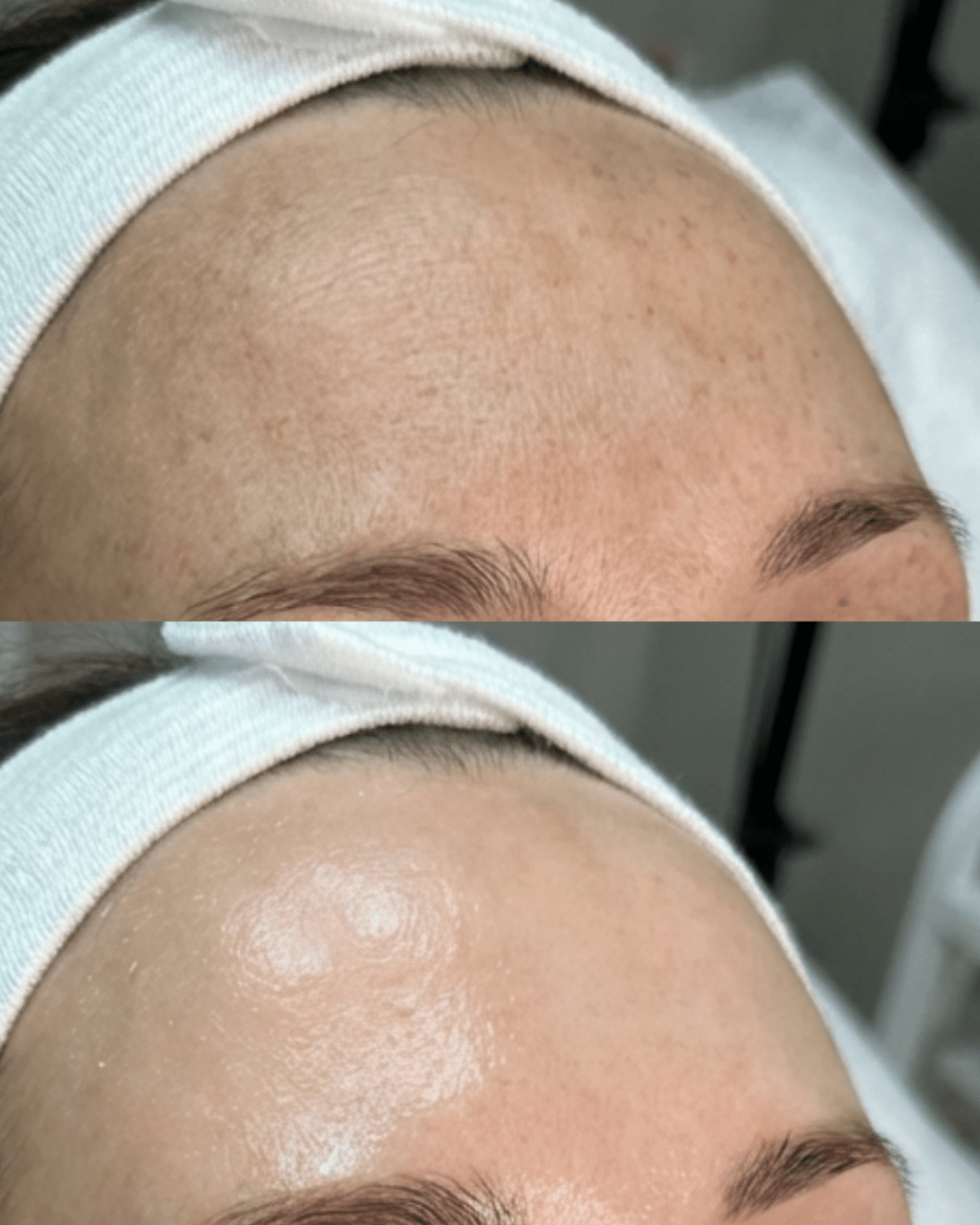 FUSION FACIAL BIRMINGHAM