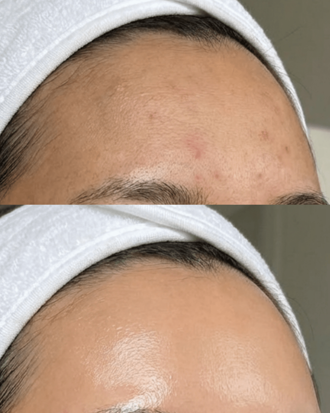 the fusion facial birmingham