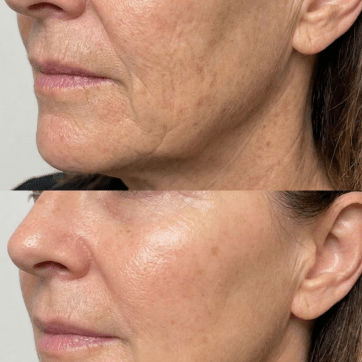 skin longevity results