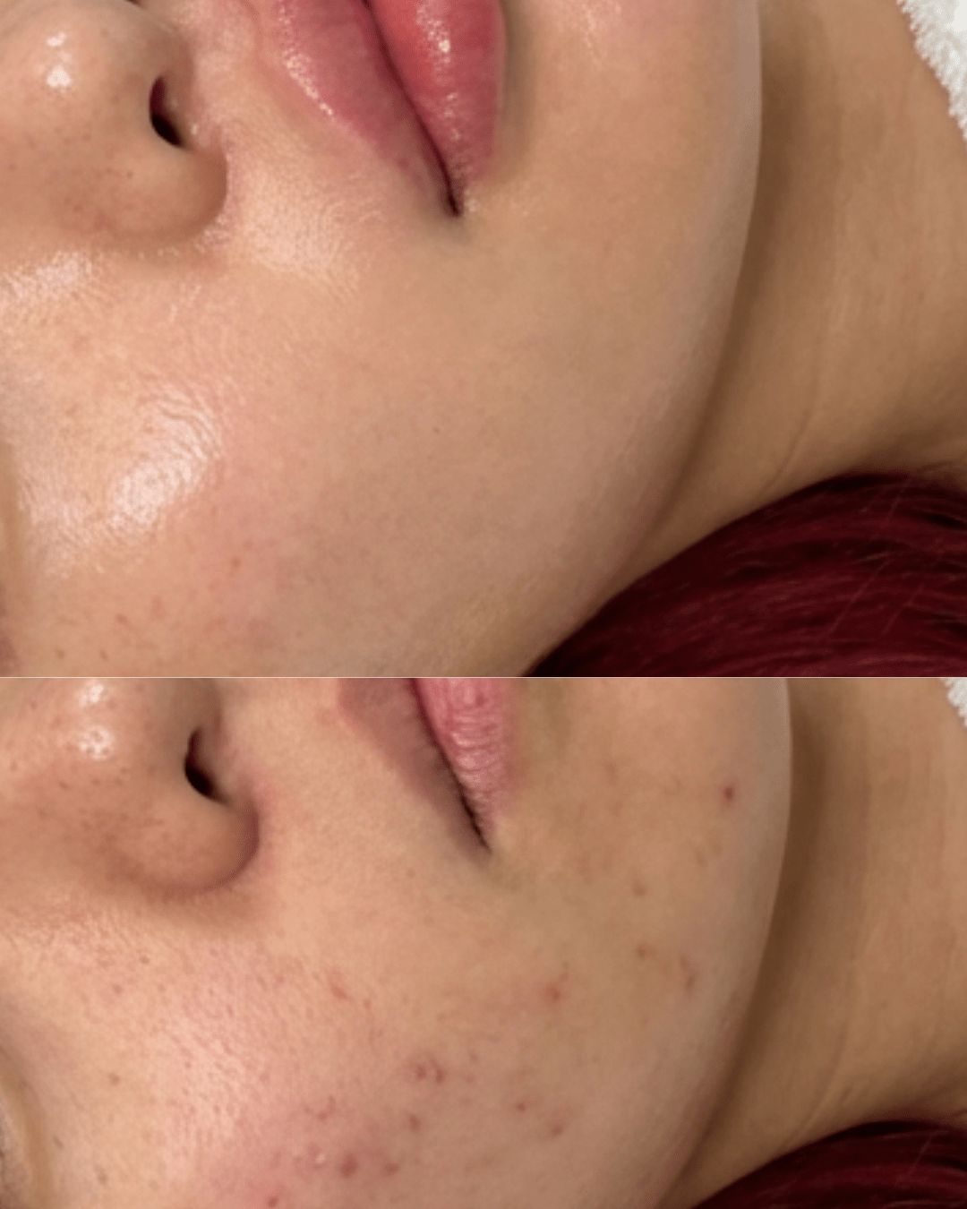 the signature glow facial sorelle skin clinic birmingham