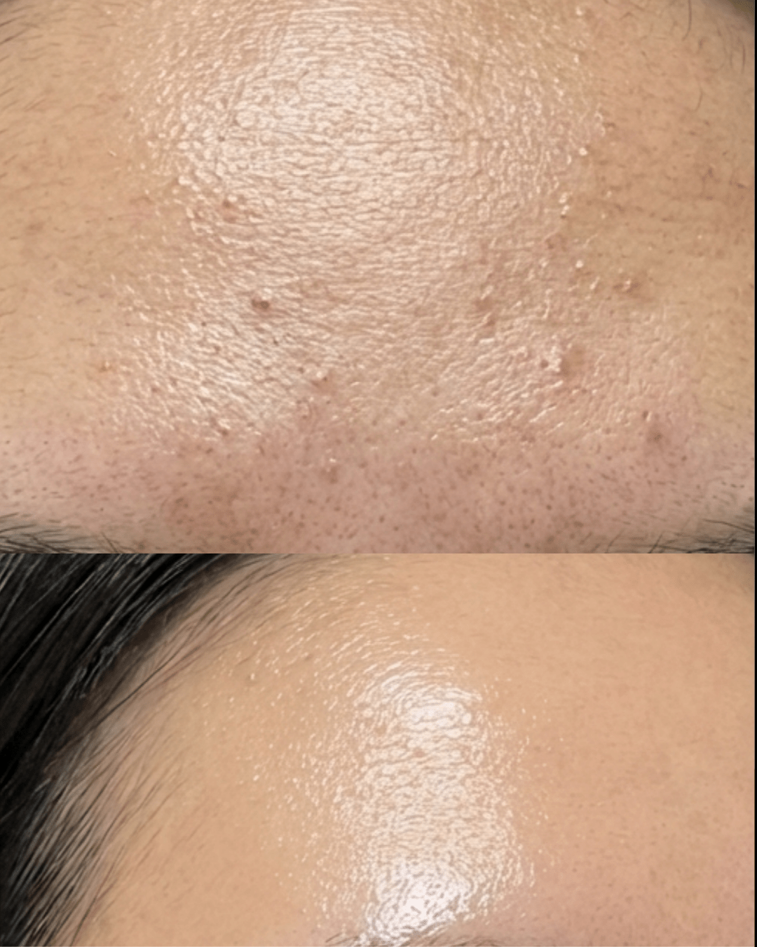 the signature glow facial in birmingham