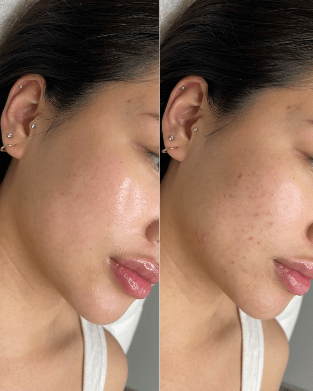 SIGNATURE GLOW FACIAL RESULTS