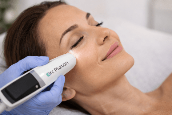 CLIENT HAVING A DR PLATON COLD PLASMA TREATMENT AT SORELLE SKIN CLINIC