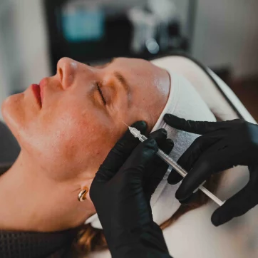 Microneedling Downtime: What Your Skin Looks Like Day-by-Day