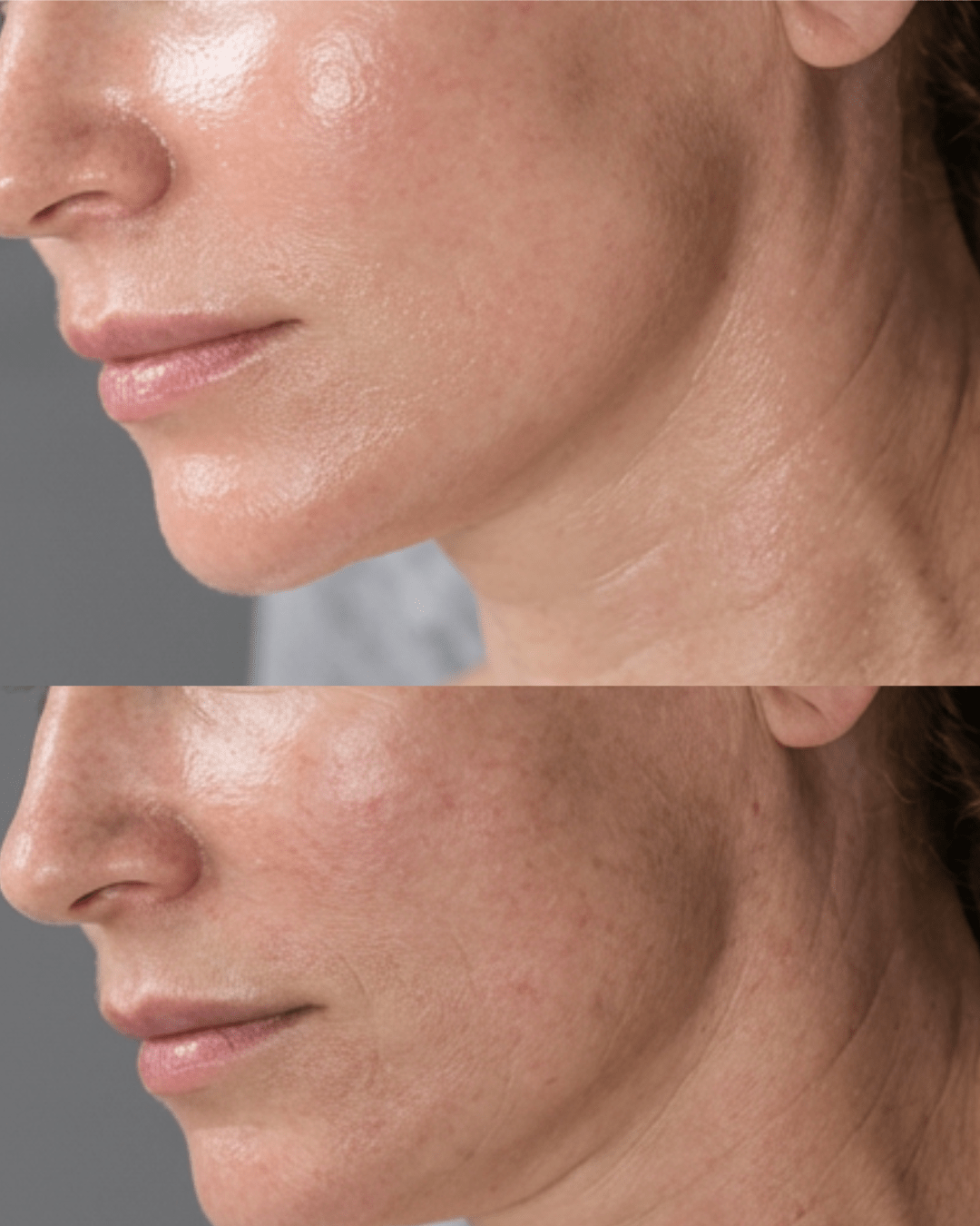 signature glow facial birmingham