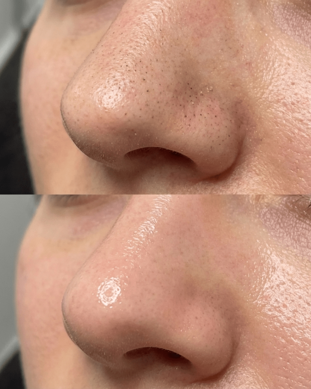 advanced facial treatment birmingham