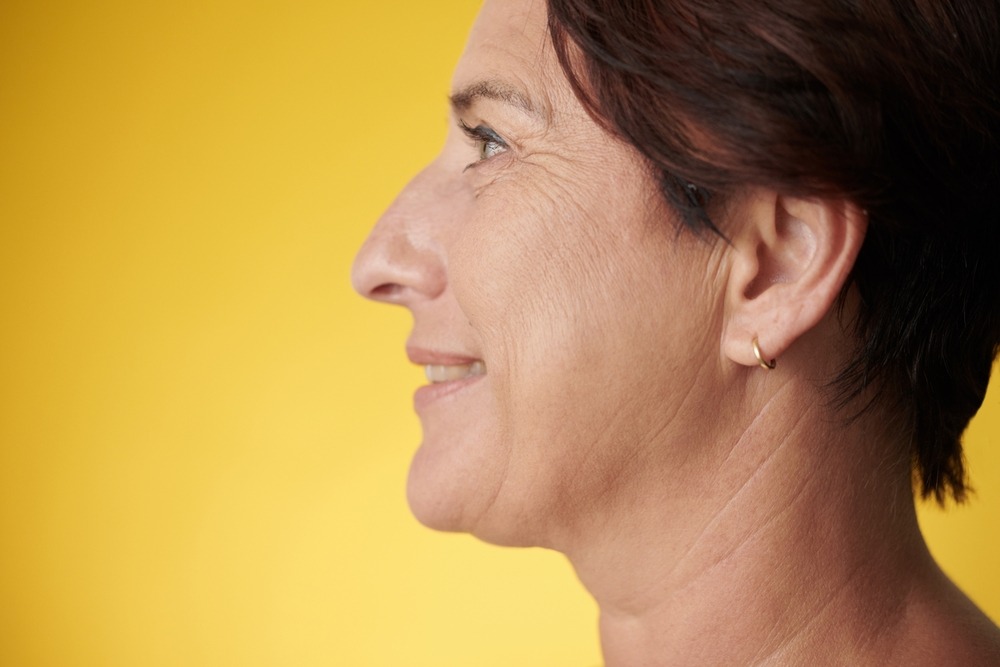 how to get rid of jowls without surgery