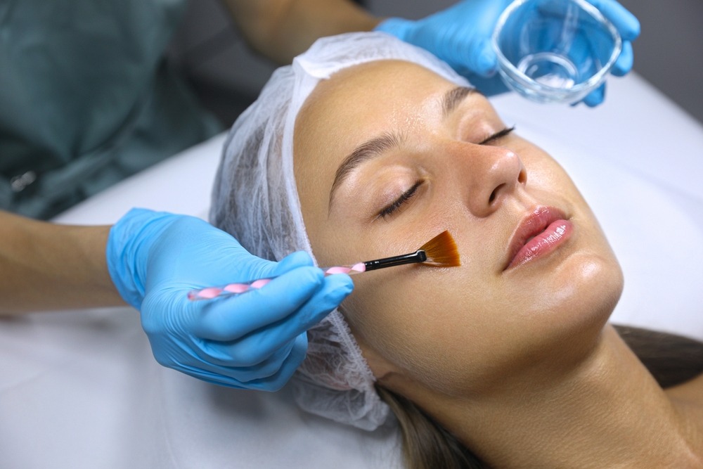 why chemical peels are best in autumn